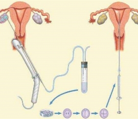 35岁女性备孕请做好以下检查，“健康东莞代生宝宝”跑不远